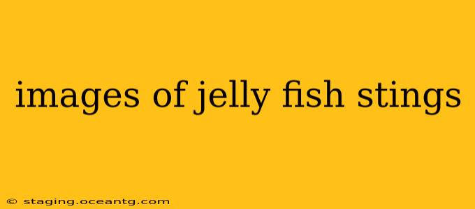 images of jelly fish stings